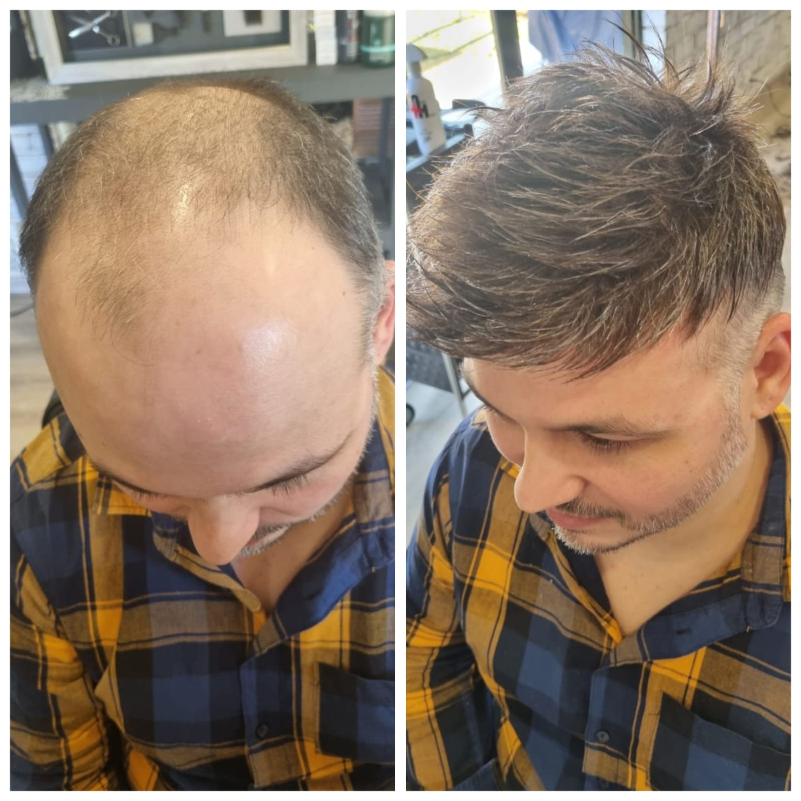 Signature Hair before and after result 2
