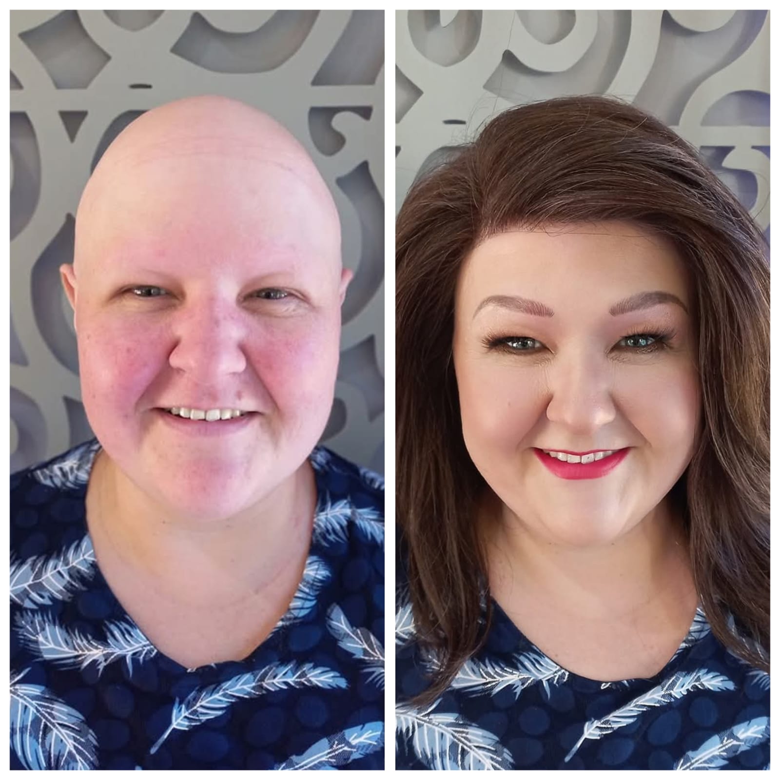 Signature Hair before and after result 6