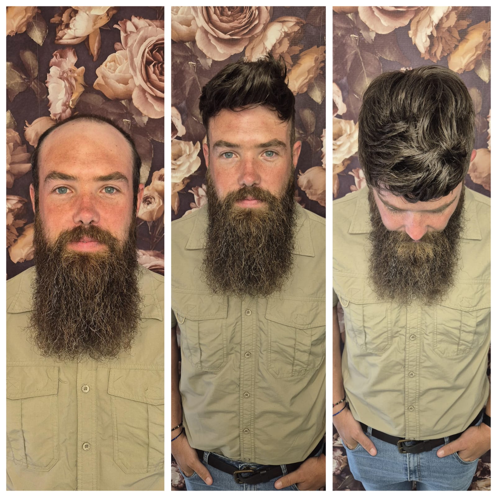 Signature Hair before and after result 7