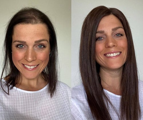 Signature Hair before and after result 8